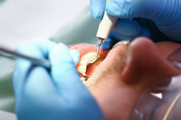 Best Emergency Dental Surgery in Niagara University, NY