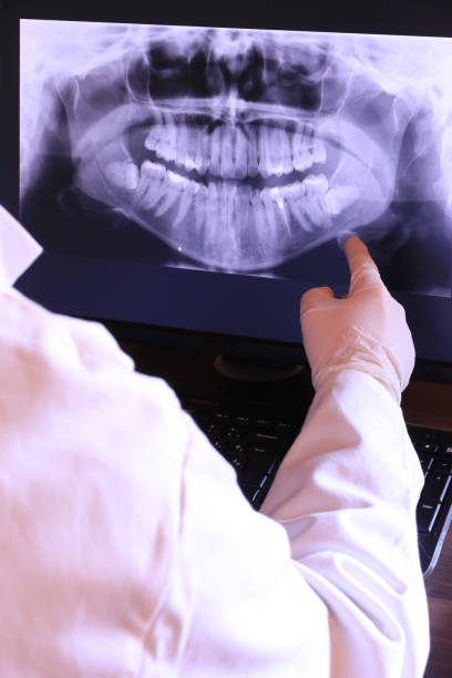 Best Emergency Broken Tooth Repair in Niagara University, NY